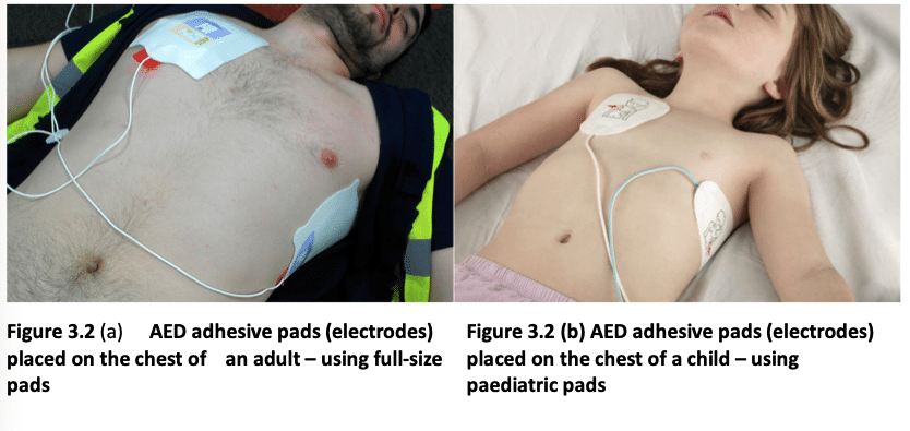 Guide to AEDs explaining how to use a defibrillator on a child